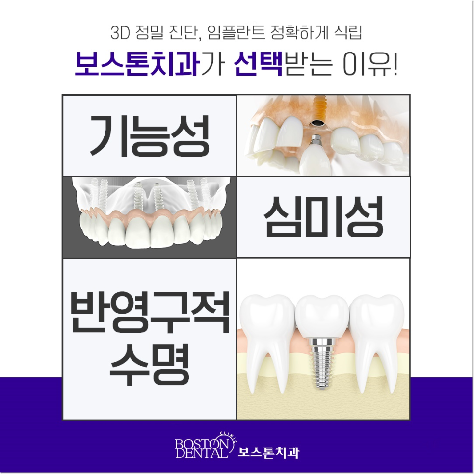 종각역 치과 상실된 치아 때문에 고민, 걱정이신가요? 관련 이미지 4