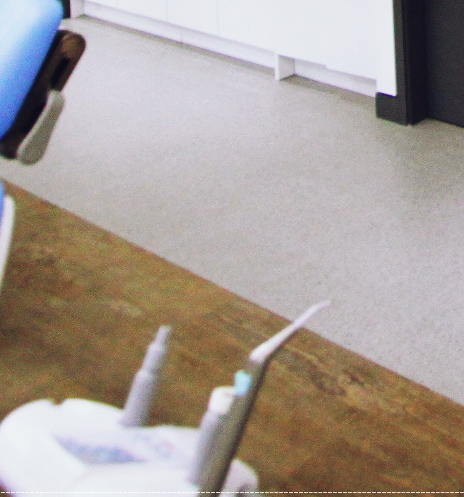 을지로치과 투명해서 티가 안 나게 교정할 수 있어요 관련 이미지 39