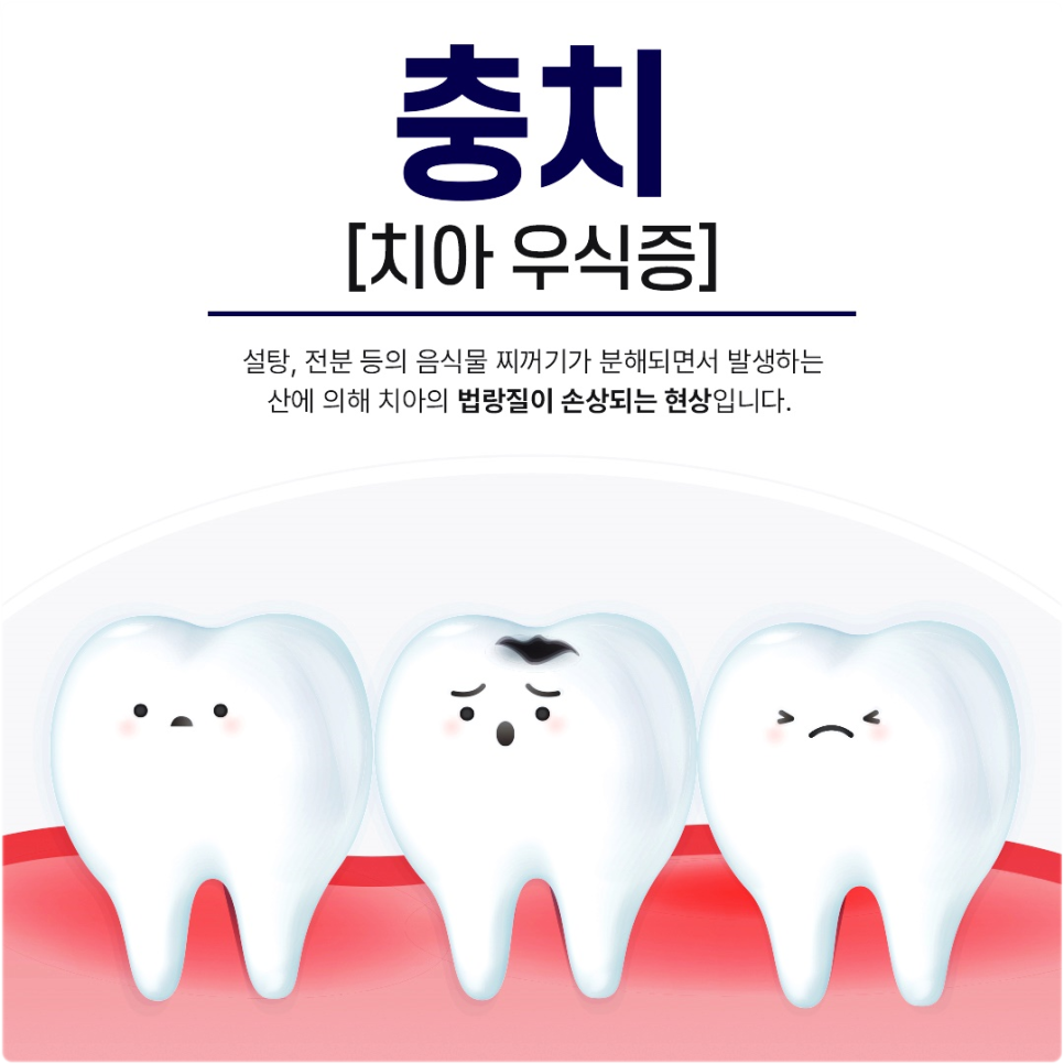 광화문역치과 신경치료 과정이 궁금해요 관련 이미지 1