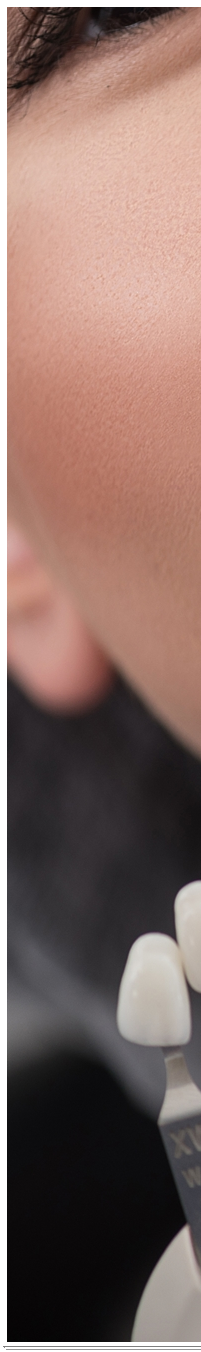 광화문역치과 치아미백과 라미네이트 나에게 필요한 건? 관련 이미지 15