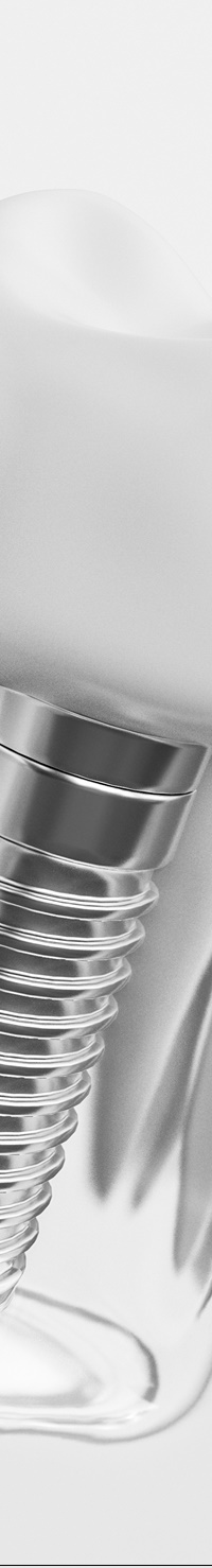 종각역치과 임플란트 치료, 짚고 넘어가세요! 관련 이미지 31