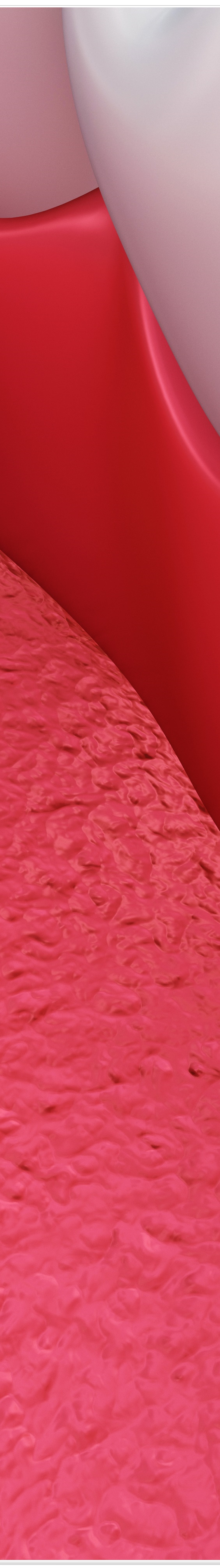 종로치과에서 알려드리는 치아미백과 라미네이트의 모든 것 관련 이미지 22