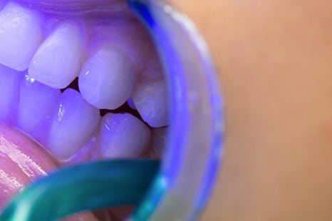 종로치과 치아미백 밝고 환하게 관련 이미지 12