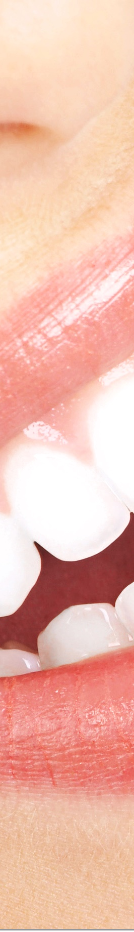 광화문역치과 라미네이트 치료가 궁금해요 관련 이미지 23