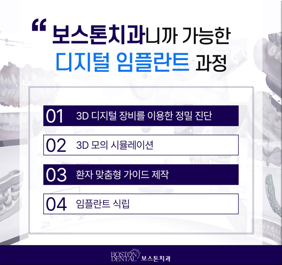 을지로치과 임플란트, 치아가 빠졌다면 어떻게 해야 할까요? 관련 이미지 4