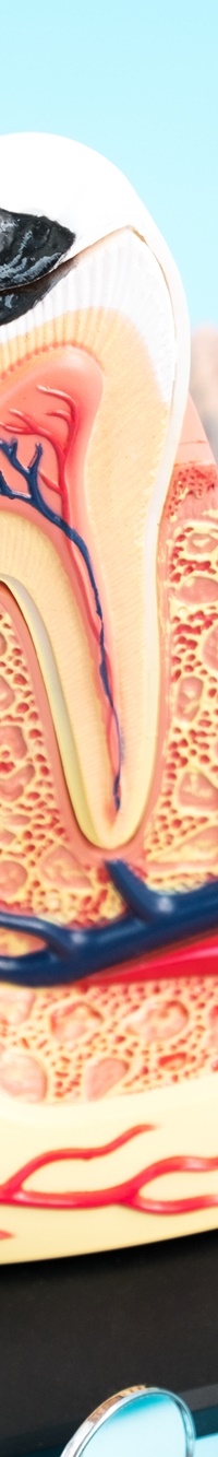 종각역치과 자연치아를 살리기 위한 대책, 신경치료 관련 이미지 30