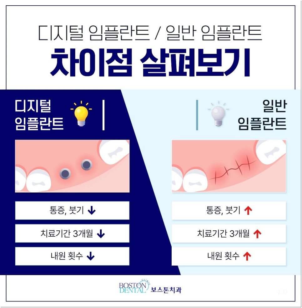 종로구치과 임플란트 하고 끝? 관리까지 잘해줘야 하는 이유 관련 이미지 6