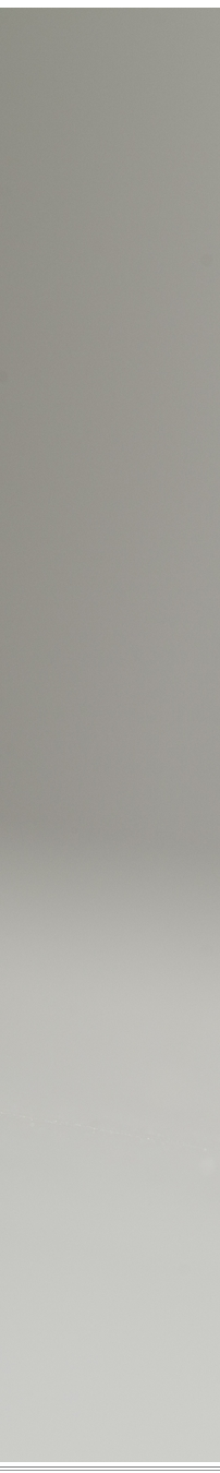 광화문역치과 치아미백과 라미네이트 나에게 필요한 건? 관련 이미지 33