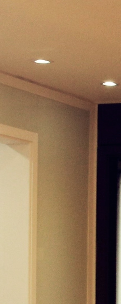 종로구치과 임플란트 하고 끝? 관리까지 잘해줘야 하는 이유 관련 이미지 12