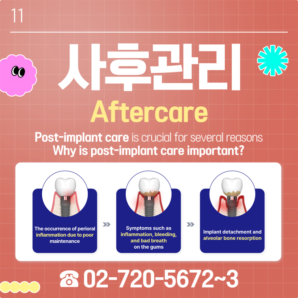 외국인 충치 치료 한국에서 할까 고민 중이라면? 관련 이미지 7