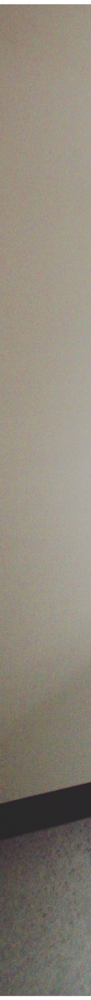 종로3가치과 음식을 잘 씹기 위해서는? 관련 이미지 22