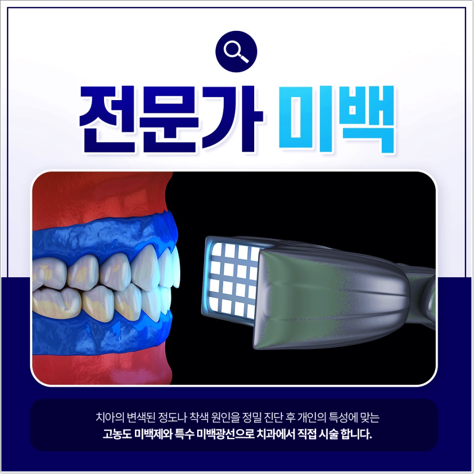 외국인치과 필수 가이드: 한국에서 알아야 할 5가지 핵심 치료 관련 이미지 4