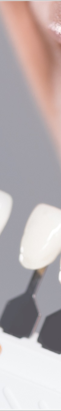 명동라미네이트, 단시간에 환한 미소를 가지고 싶다면? 관련 이미지 19