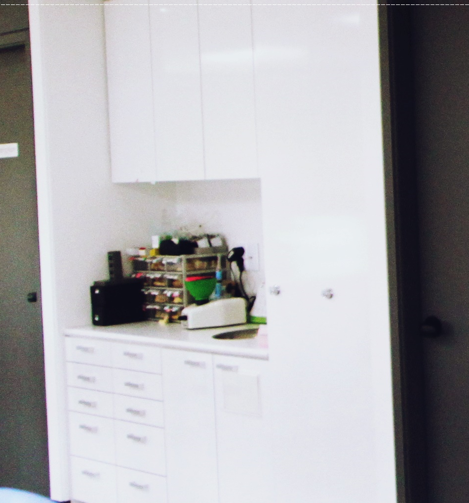 을지로치과 투명해서 티가 안 나게 교정할 수 있어요 관련 이미지 46