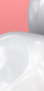 명동역치과 라미네이트 삭제된 치아는 다시 자라지 않습니다. 관련 이미지 29