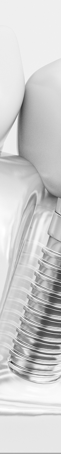 종각역치과 임플란트 치료, 짚고 넘어가세요! 관련 이미지 30