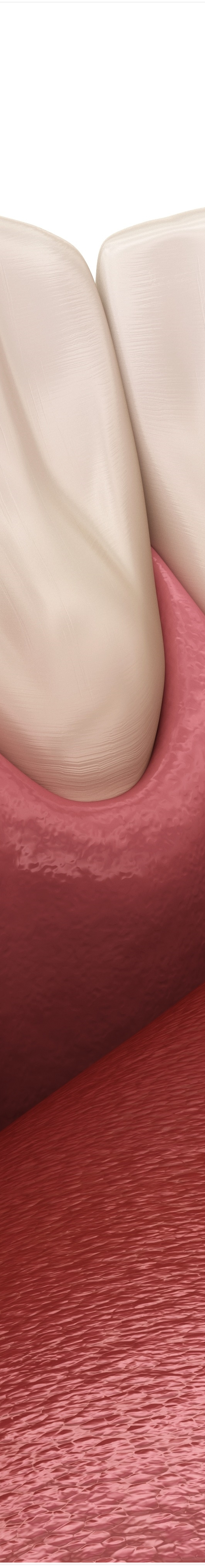 명동치과 치아가 욱씬욱씬 아프신가요? 관련 이미지 38