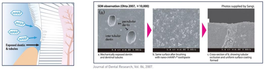 충치예방부터 시린이 완화까지! 아파프로 치아영양제의 5가지 효과✨ / 강남레옹치과 관련 이미지 6