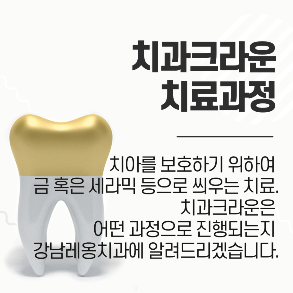 치아 크라운 과정, 어떤 순서로 진행이 될까? 관련 이미지 1