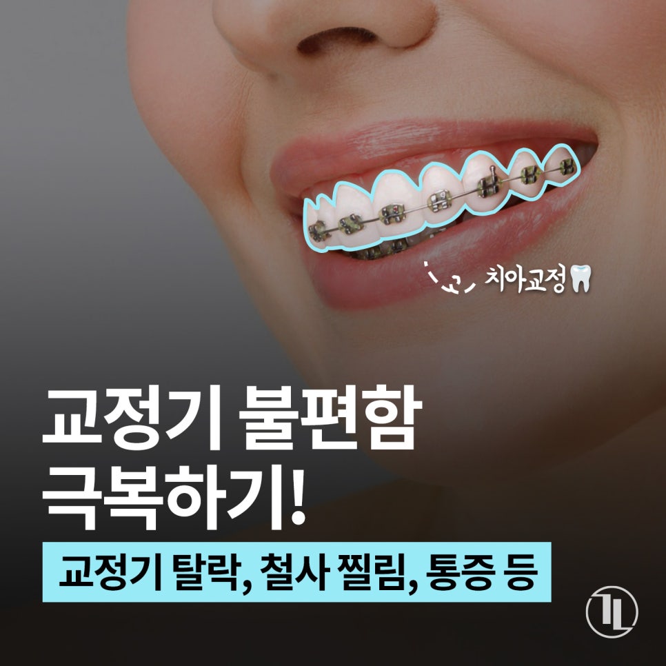 치아교정할 때 겪는 모든 문제😵 교정기 탈락, 철사 찔림, 통증 총정리!🗃️ 관련 이미지 1