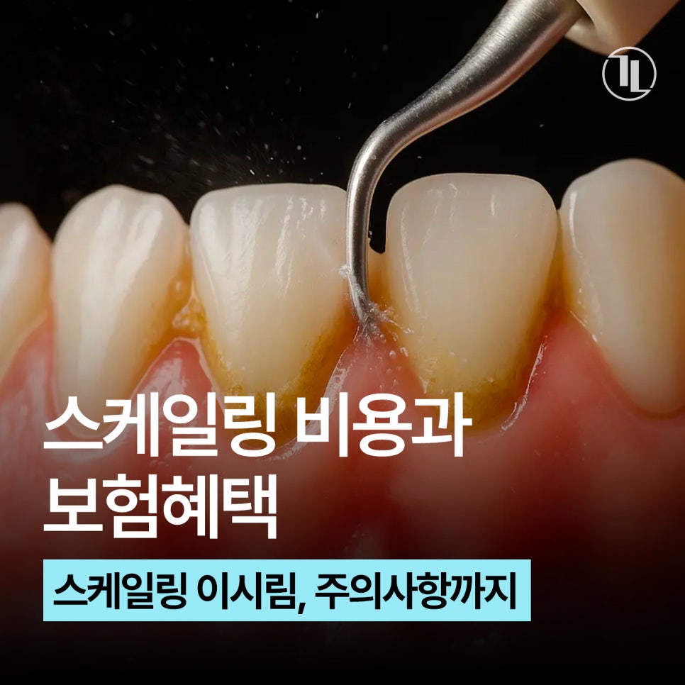 2026 스케일링 비용 / 스케일링 이 시림, 식사, 자주묻는 질문 총정리 / 강남레옹치과 관련 이미지 1