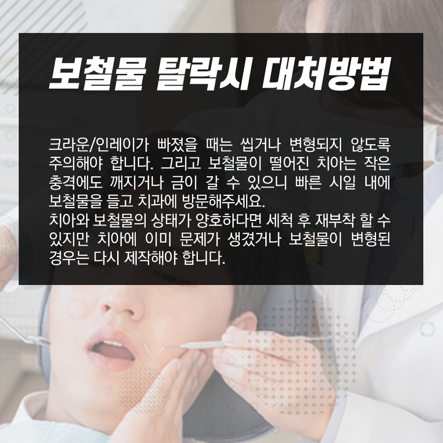 강남역치과 금니 빠짐 원인!? 크라운 / 인레이 탈락 시 대처방법 관련 이미지 4