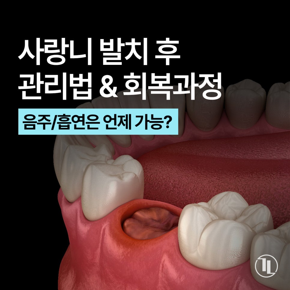 사랑니 발치 후 관리 & 회복 과정 한 눈에 보기👀! / 강남레옹치과 관련 이미지 1