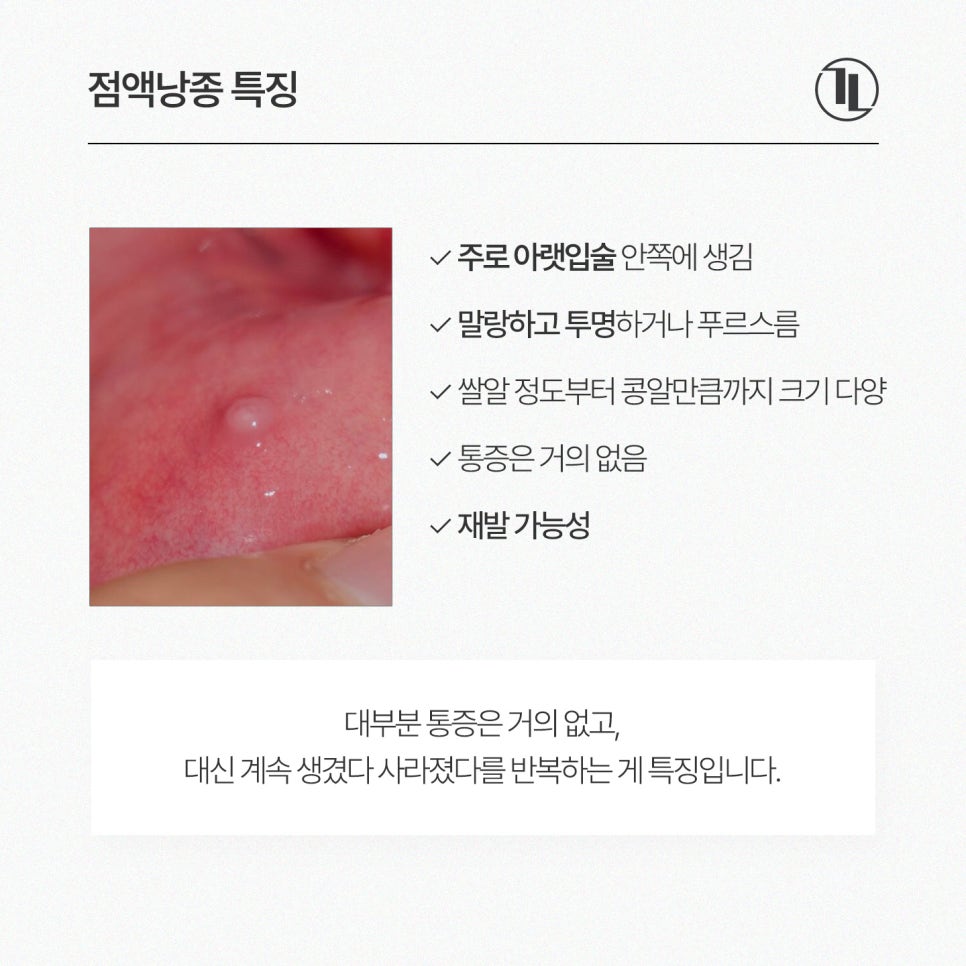 입술 안쪽에 말랑한 멍울, 그냥 둬도 괜찮을까? / 점액낭종 특징과 치료 / 강남레옹치과 관련 이미지 3