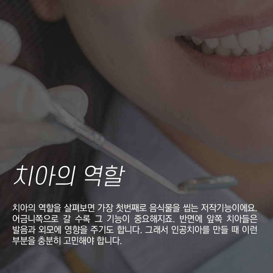 앞니 라미네이트 올세라믹 크라운 가격. 왜 어금니보다 비싼가?? 관련 이미지 2