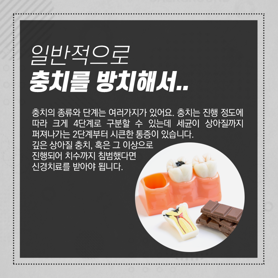 강남레옹치과 신경치료 과정 비용 정리해드려요~ 관련 이미지 3