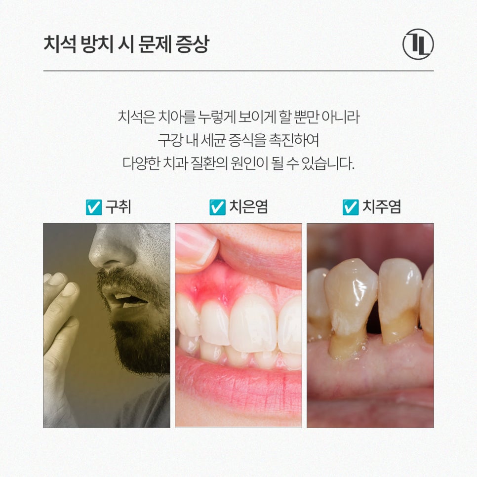 2026 스케일링 비용 / 스케일링 이 시림, 식사, 자주묻는 질문 총정리 / 강남레옹치과 관련 이미지 3
