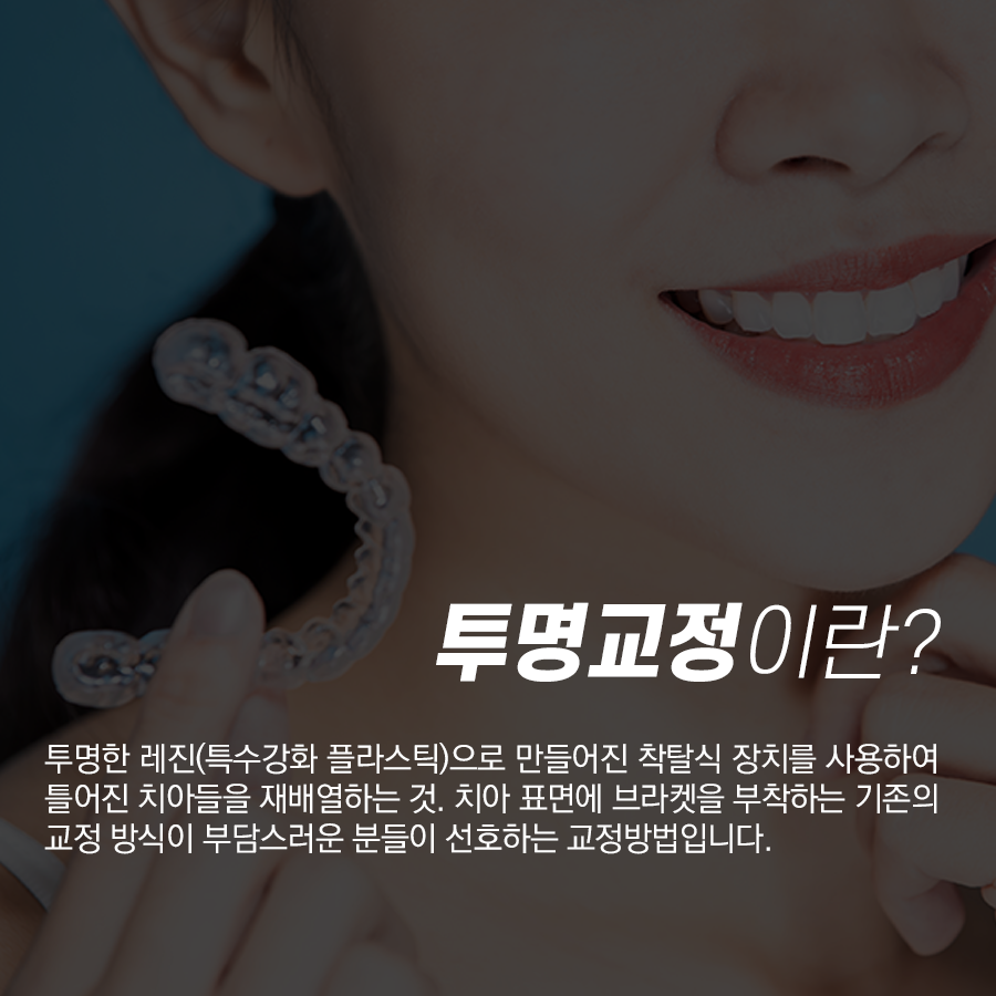 강남레옹치과 티 안나게 부정교합 변화를?! 투명교정 장단점에 관하여 관련 이미지 2