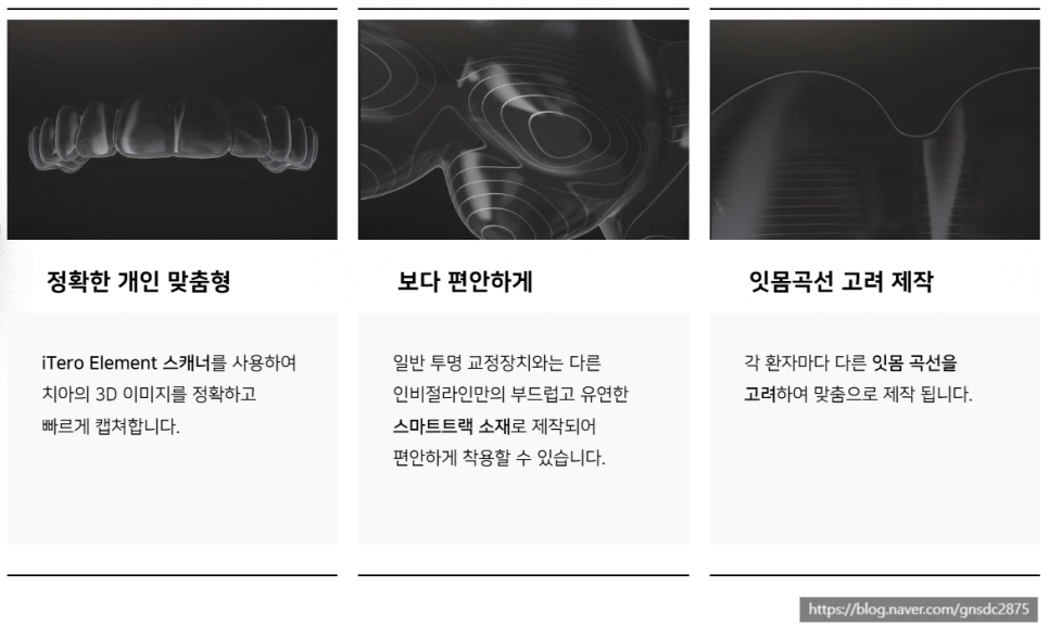 인비절라인 특징&middot;후기&middot;가격 총정리! 투명교정 완벽 가이드 / 강남역 교정치과 강남레옹치과 관련 이미지 3