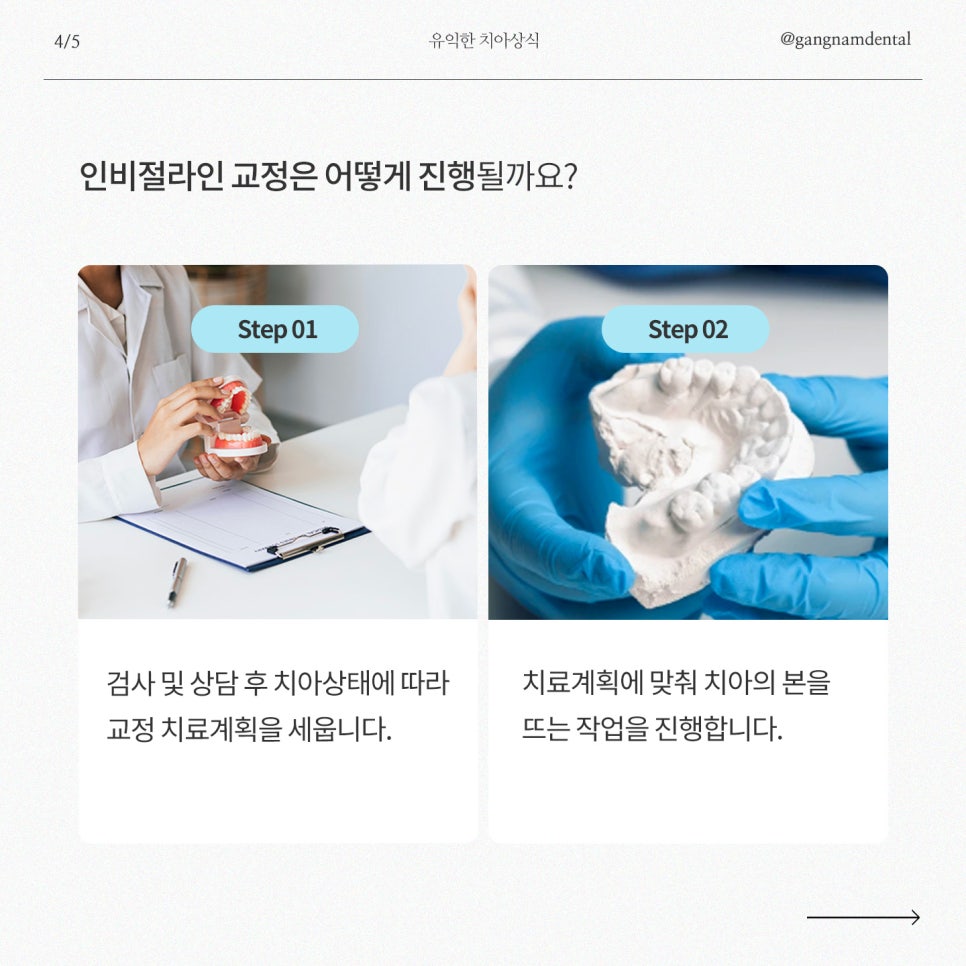 강남역치과, 여름방학 앞두고 우리 아이 투명교정 인비절라인에 대해 고민하고 계신다면? 관련 이미지 5