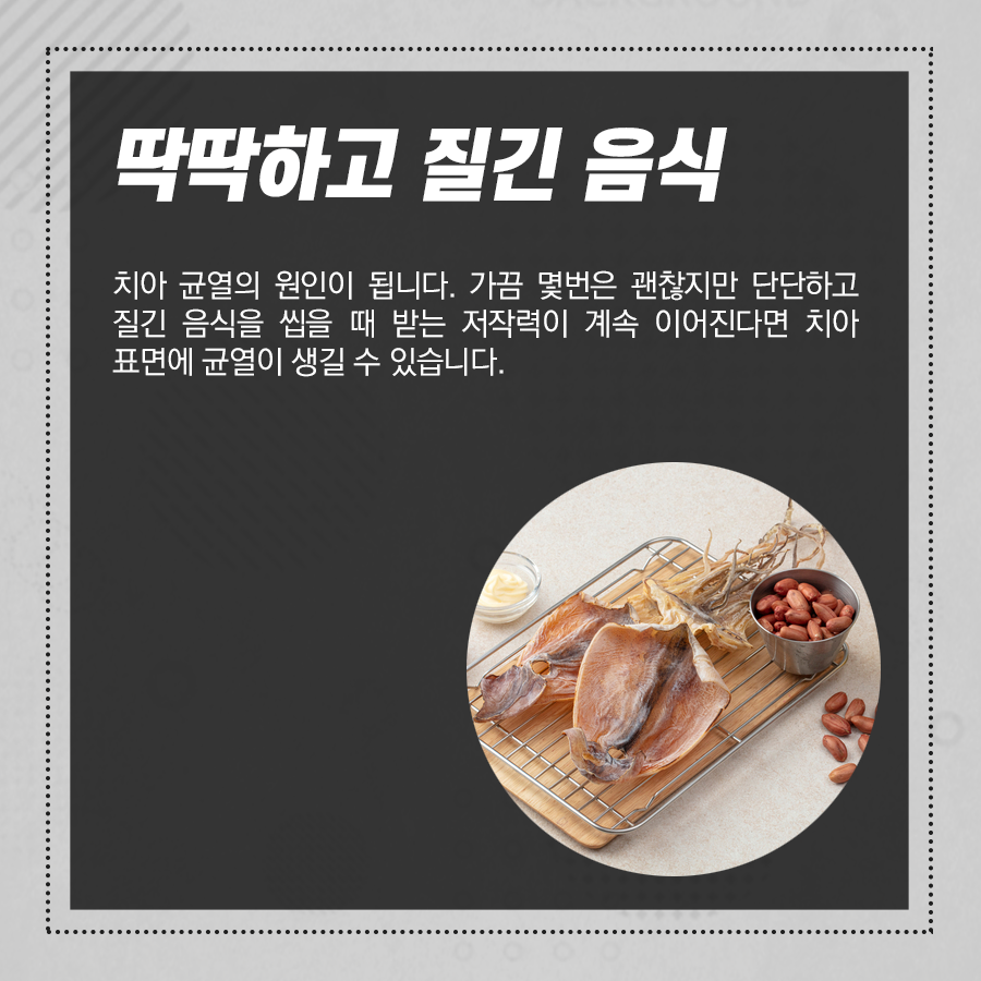 치아크랙? 치아에 금이 가는 이유, 균열 생겼을 때 증상 관련 이미지 3