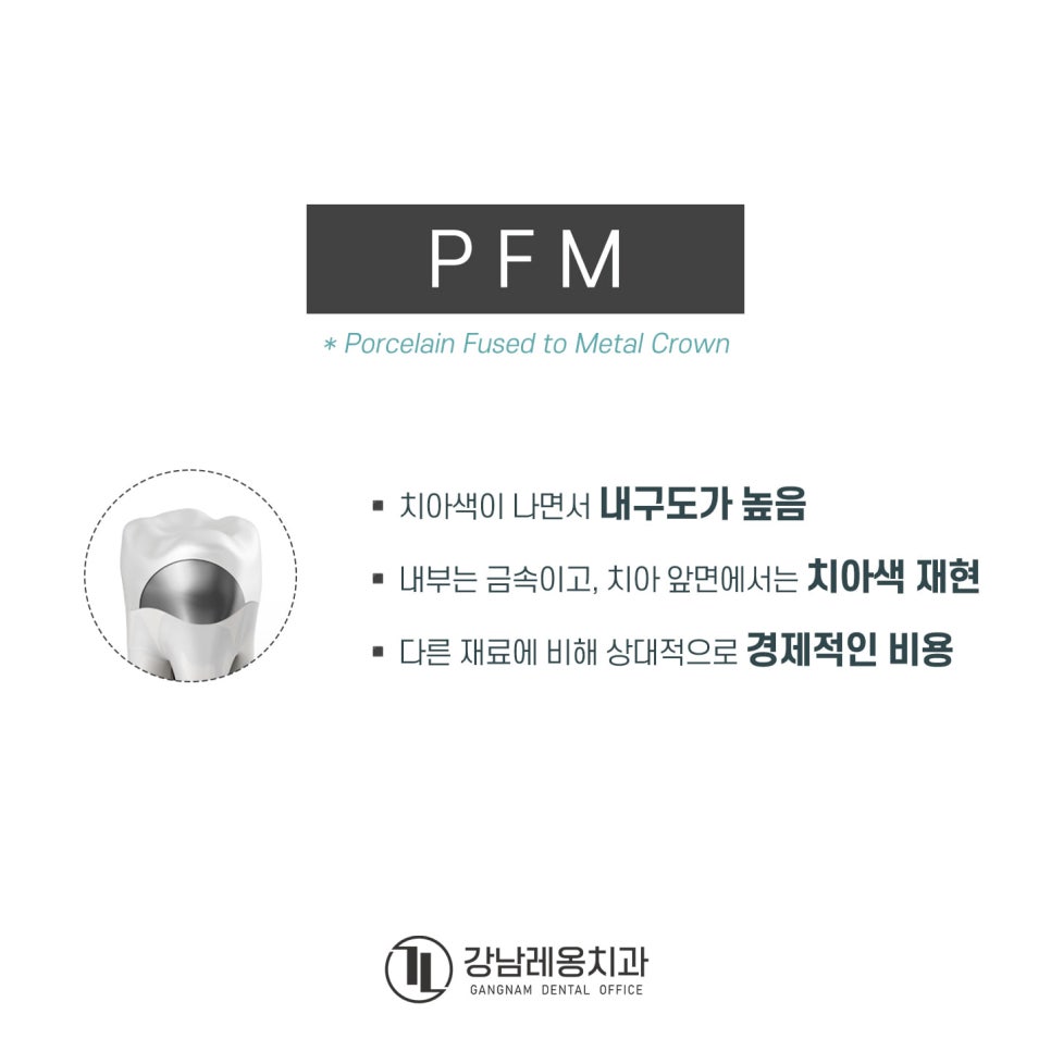 신경치료 후 남아 있는 자연치아 보호를 위한 &lsquo;크라운 치료&rsquo;의 종류와 특징은? 관련 이미지 5