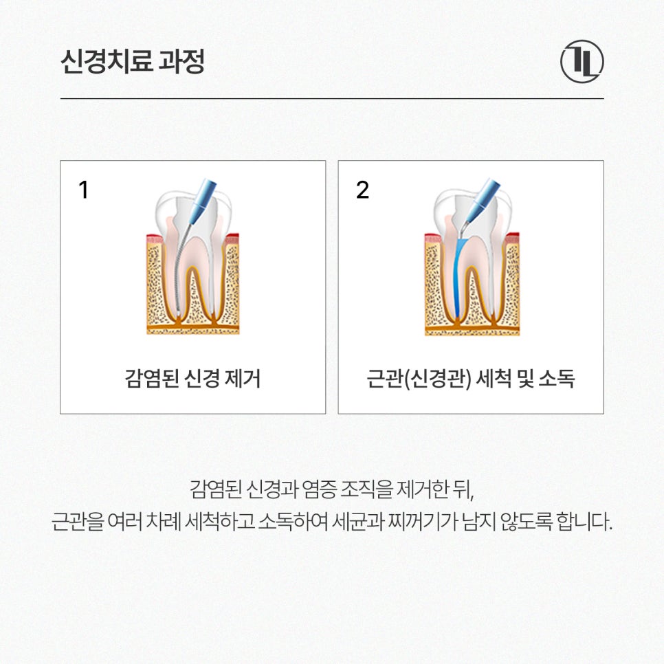 찌릿한 치통? 신경치료 완전 이해하기🧐 / 강남레옹치과 관련 이미지 4