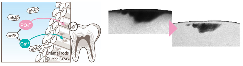 치아성분 치아영양제 아파프로로 약해진 치아관리! / 강남레옹치과 관련 이미지 5