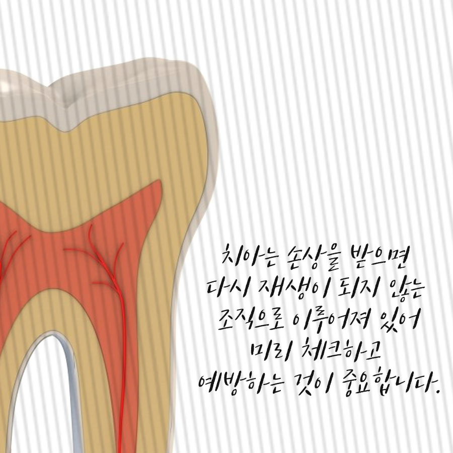 충치치료 치과 세심하게 고르기! 관련 이미지 1