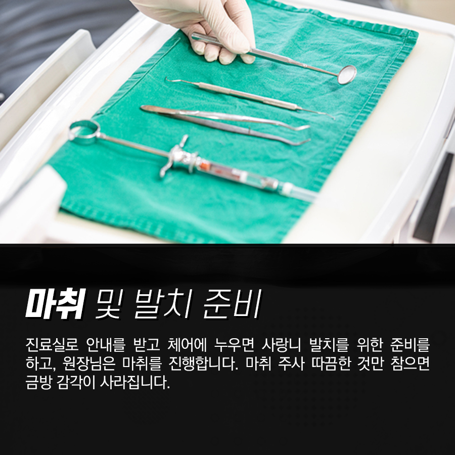 누운 사랑니 발치 과정, 매복 된 상태라면 검사 후 이런 순서로 뽑아요 관련 이미지 4