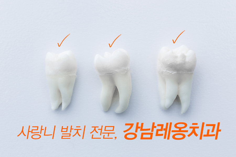 강남사랑니발치 월 500개 이상! 관련 이미지 2