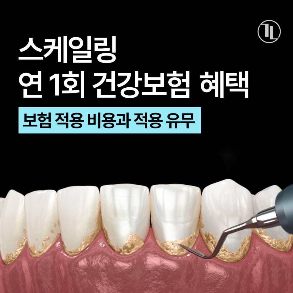 보험 스케일링 비용 얼마일까? 연 1회 건강보험 혜택 알아보기 / 강남레옹치과 관련 이미지 1