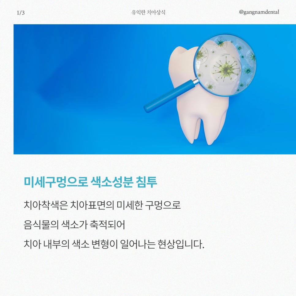 치아착색 치아변색 유발하는 습관! 누렁니 이렇게 예방하세요 / 강남레옹치과 관련 이미지 2