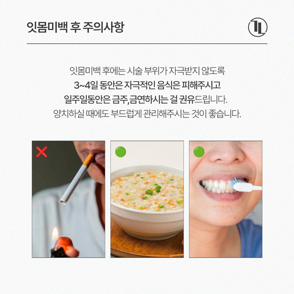 검은 잇몸, 원인부터 잇몸미백 치료과정, 주의사항까지 한눈에 보기👀 / 강남레옹치과 관련 이미지 4