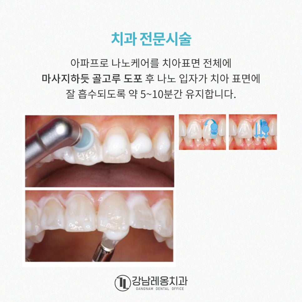 충치예방부터 시린이 완화까지! 아파프로 치아영양제의 5가지 효과✨ / 강남레옹치과 관련 이미지 13