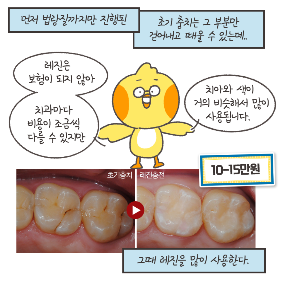 냐폴레옹 치과툰) 사람마다 다른 충치치료 비용 관련 이미지 6