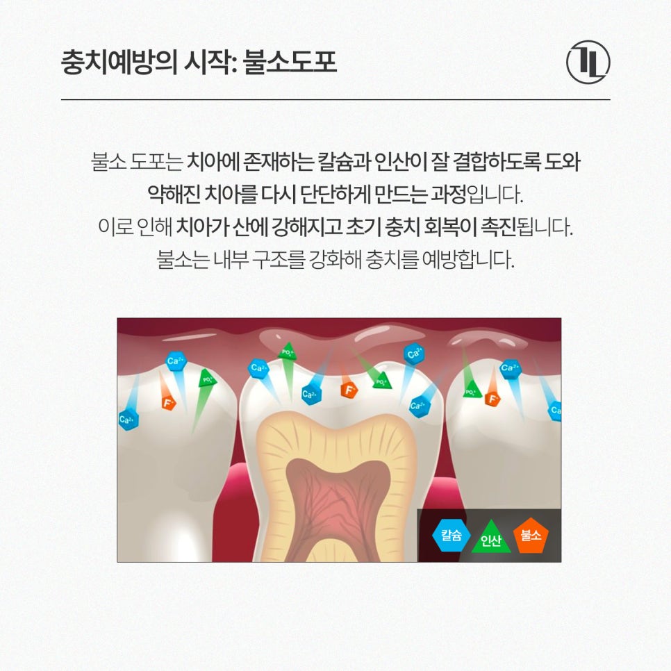아기 불소도포 시기, 주기, 안정성 총정리 한눈에 보기🧐 / 강남레옹치과 관련 이미지 2