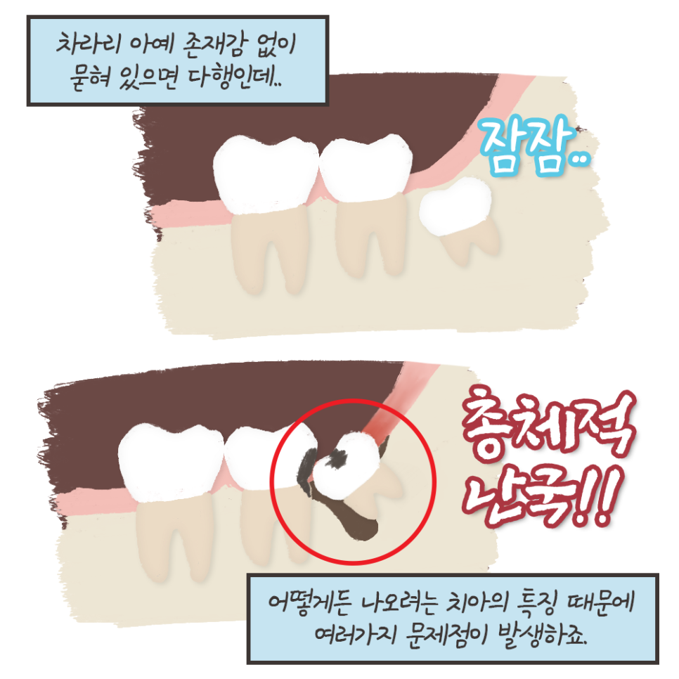 사랑니 안 뽑으면? 묻고 떠블로 가!! (냐폴레옹 치과툰) 관련 이미지 5