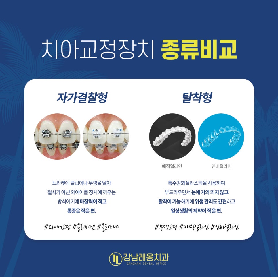 치아교정의 장치&종류&특징에 대해 알아봐요! 강남레옹치과와 함께 관련 이미지 4