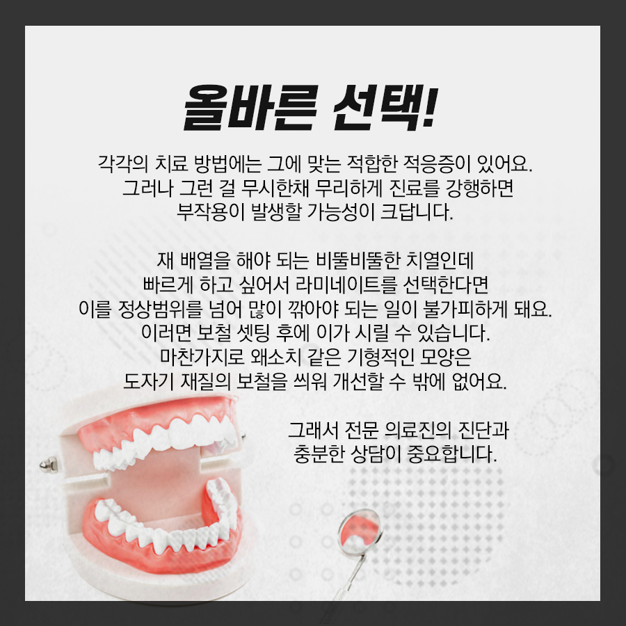 치아교정, 라미네이트 장단점과 차이점을 명확하게 알자! 관련 이미지 5